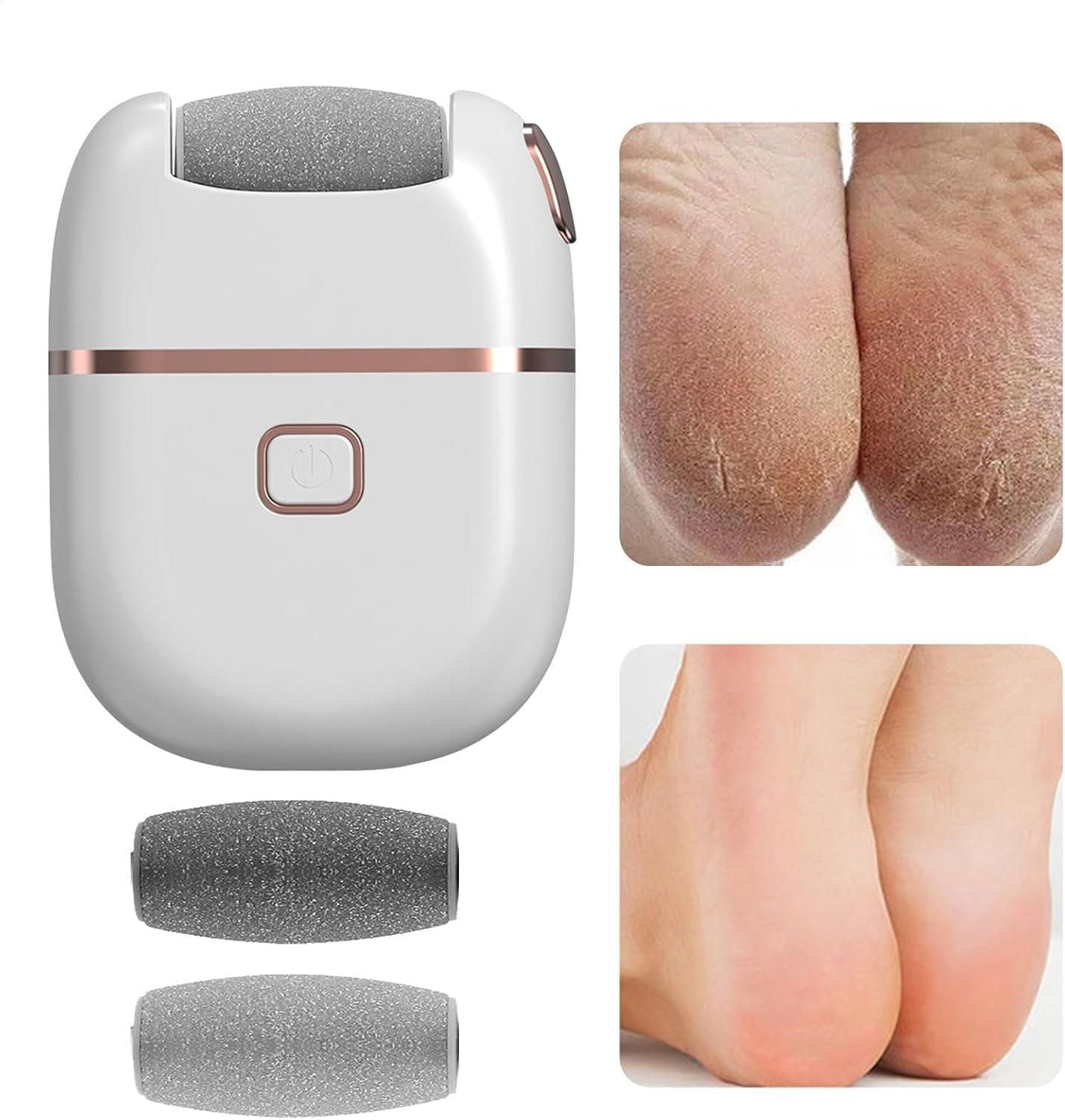 Electronic Pedicure Tool 🦶✨