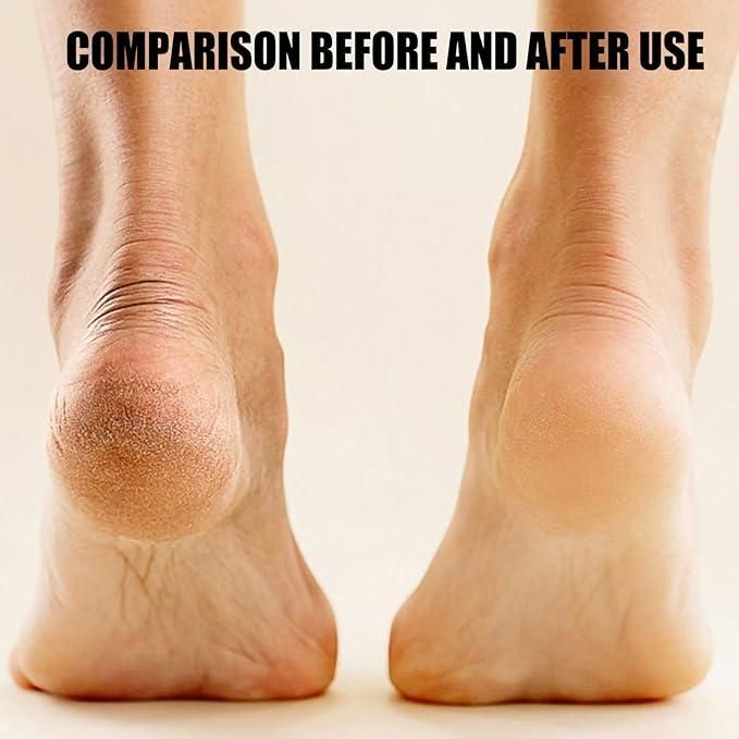 Electronic Pedicure Tool 🦶✨